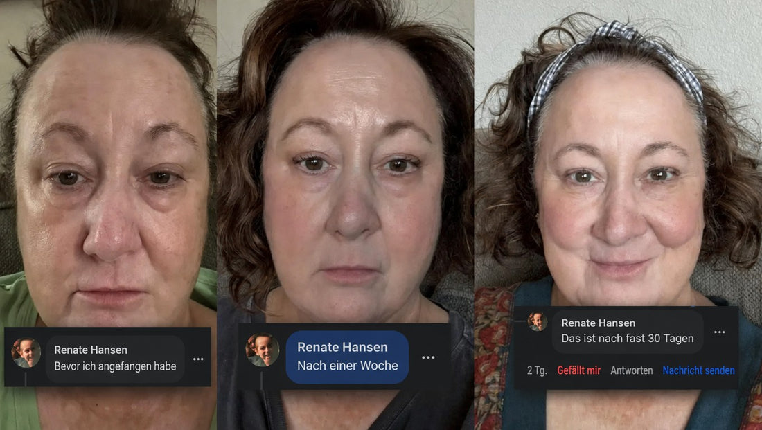 Renate Hansen vorher, nach einer Woche und nach 30 Tagen
